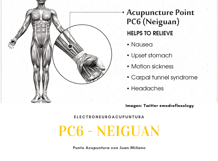 pc6-neiguan-nervio-mediano
